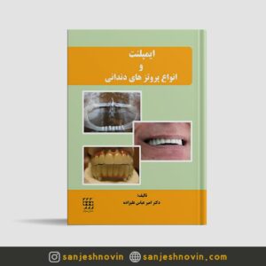 کتاب ایمپلنت و انواع پروتزهای دندانی